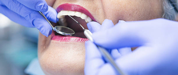 Best Walk-In Emergency Dentist in Helena West Side, MT